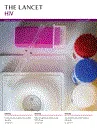 Lancet HIV (The)